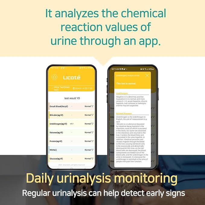Pet Urine Test Kit for Dogs & Cats Analyzer Device + 25 Test Strips | at-Home Health Check | Detects 10 Urinary Conditions | Easy-to-Use Smart App | Veterinary Grade