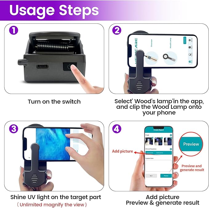 Woods Lamp with Magnifying Glass, Rechargeable UV Flashlight Skin Analyzer, 365nm Ultraviolet Light LED Black Light for Pet Cat Urine Detection, Resin Curing, Cat Dog Ringworm