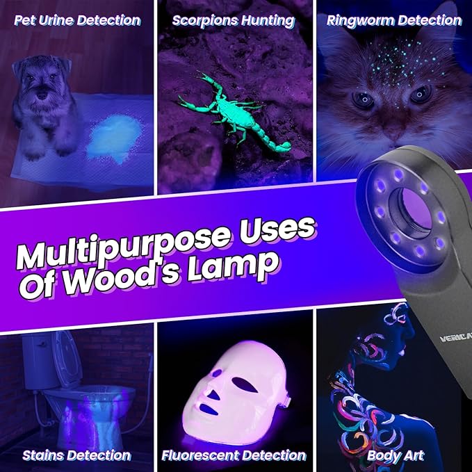 Woods Lamp with Magnifying Glass, Rechargeable UV Flashlight Skin Analyzer, 365nm Ultraviolet Light LED Black Light for Pet Cat Urine Detection, Resin Curing, Cat Dog Ringworm